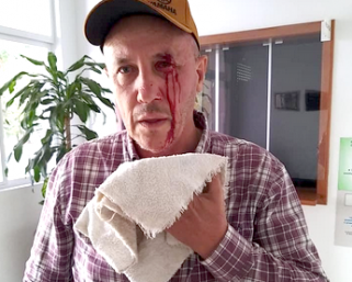 Ex-candidato a vice-prefeito sofre agressão